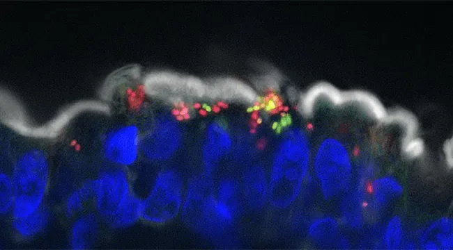 Leigh Knodler's Salmonella research, UVM Larner College of Medicine